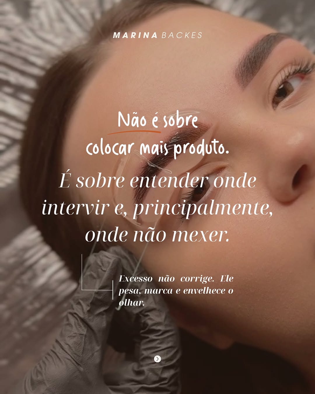 Depois — CASO 1